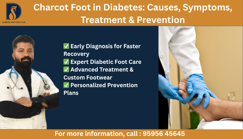 Charcot Foot