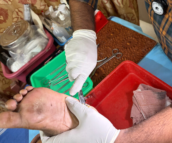 diabetic wound care in Trichy